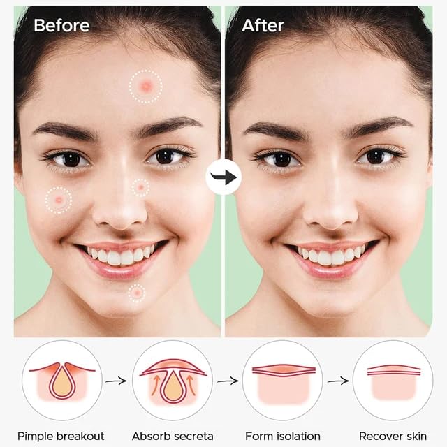 Tratamientos, Drugstore Imagen adicional