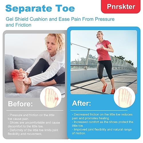 Image of Pinky Toe Protector, (20pcs) Breathable Toe Cap, Gel Toe Sleeve,Toe Covers Great for Blisters, Corns, Hammer Toes, Toenails Loss (Aloe Vera Extract Infused Silicone Materials)