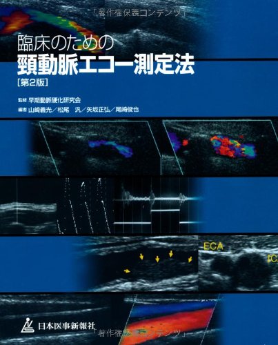 臨床のための頸動脈エコー測定法 第2版 | 山崎 義光 |本 | 通販 | Amazon