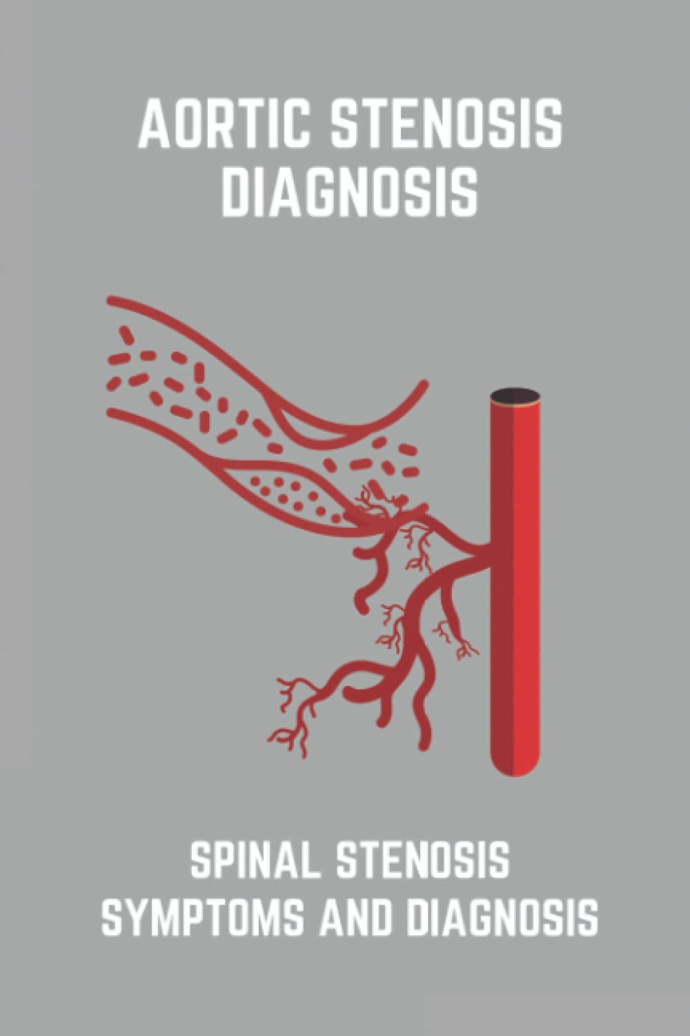 Aortic Stenosis Diagnosis: Spinal Stenosis Symptoms And Diagnosis