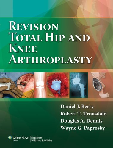 Revision Total Hip And Knee Arthroplasty