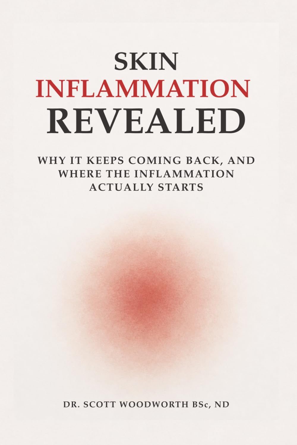Skin Inflammation Revealed: Why It Keeps Coming Back, And Where The Inflammation Actually Starts