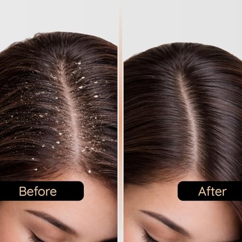 Image of By Naked Fact Black Soil Anti Dandruff Shampoo for Men & Women | Natural Pro Repair | Anti Hair Fall With Omega 3 Flax seeds Jatamansi Extract, Moringa Leaf Extract | Sulphate Paraben Free | 250ml