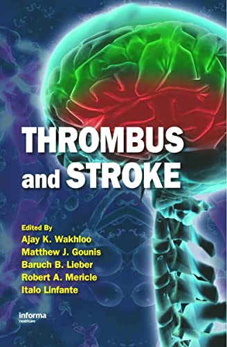 Thrombus and Stroke (Neurological Disease and Therapy)
