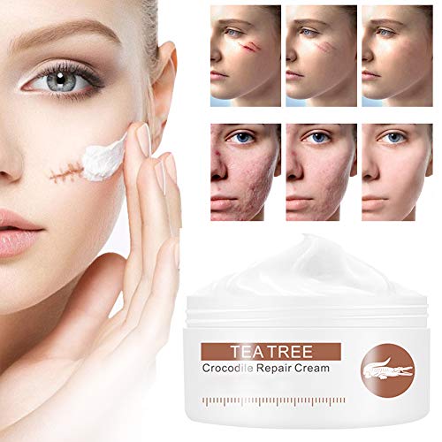 Scar Cream,Scar Removal Cream Gel,Scar Treatment,Scar Repair Cream,Acne Spots Treatment,Scar Gel Remove & Lighten Old & New Scars,Acne Scar Removal Cream,Face Skin Repair Cream