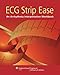 ECG Strip Ease