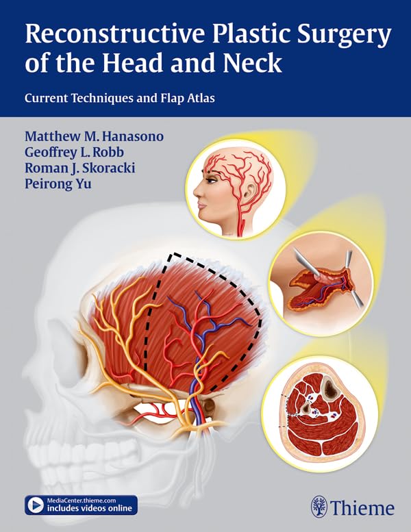 Reconstructive Plastic Surgery of the Head and Neck: Current Techniques and Flap Atlas (English Edition)