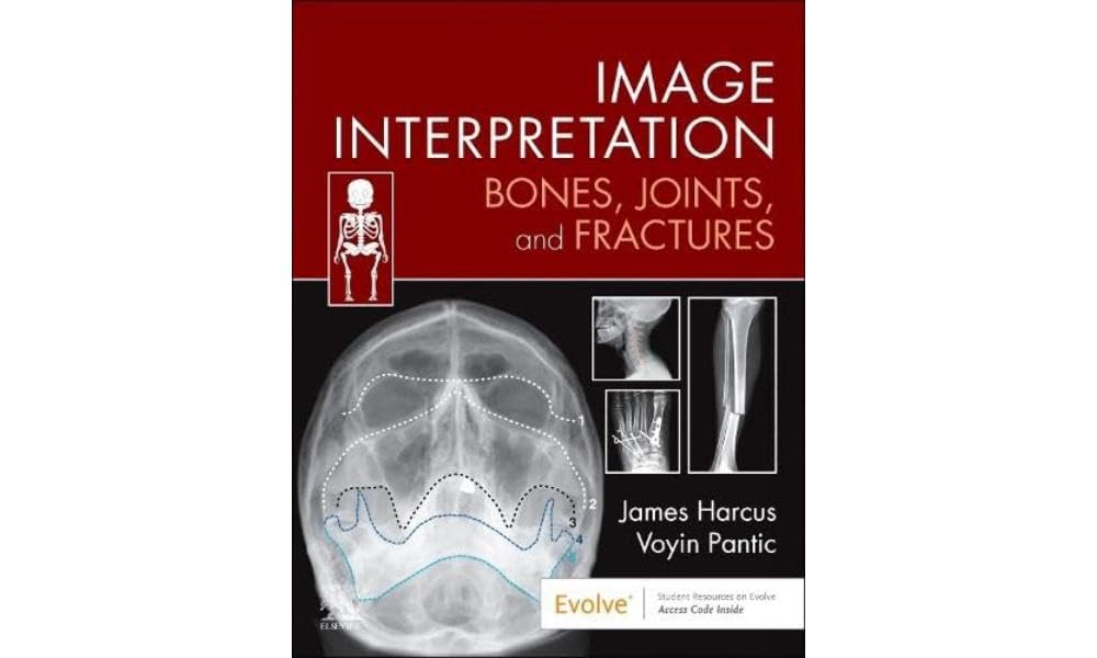 Image Interpretation: Bones, Joints, and Fractures (Evolve: Student Resources)
