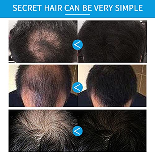 Hair Fibers For Thinning Hair With Spray,Undetectable Natural Formula,Thicker Fuller Hair In 15 Seconds,Instantly Conceal & Thicken Thinning Or Balding Hair Areas,For Men&Women，Black #TOP2