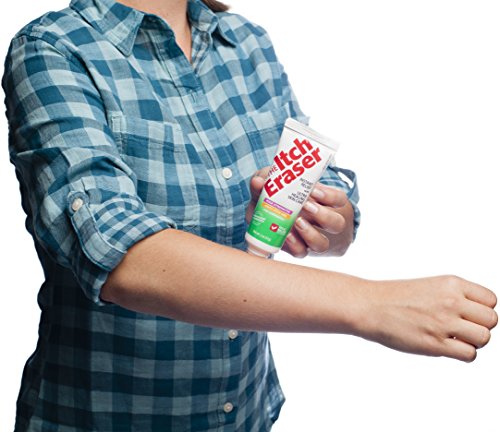 The Itch Eraser Max Strength Gel – Steroid-Free Anti-Itch Gel With Antihistamine For Fast Itch Relief #TOP6