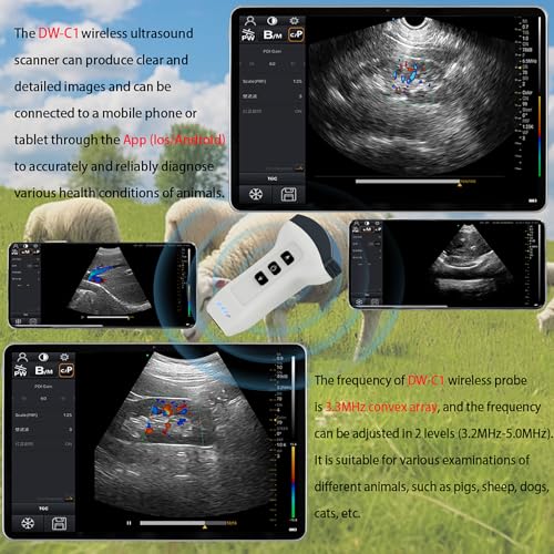 Daweianimed DW Wireless Color Doppler Ultrasound Machine 3.5Mhz Convex Probe thumb #3