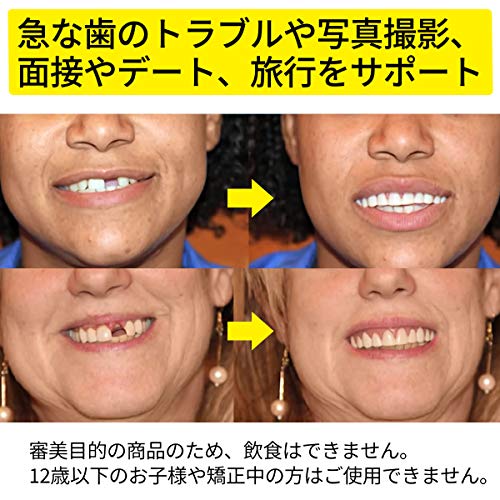 Instant Smile Teeth Small Deluxe Top Veneers Fake Cosmetic Dr Bailey's Fitting - Thumbnail 4