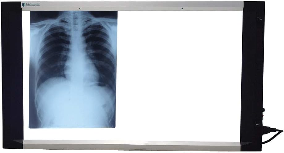 IS IndoSurgicals Ultra Slim, Double Film X-Ray View Box With Sensor & Dimmer for Brightness Adjustment