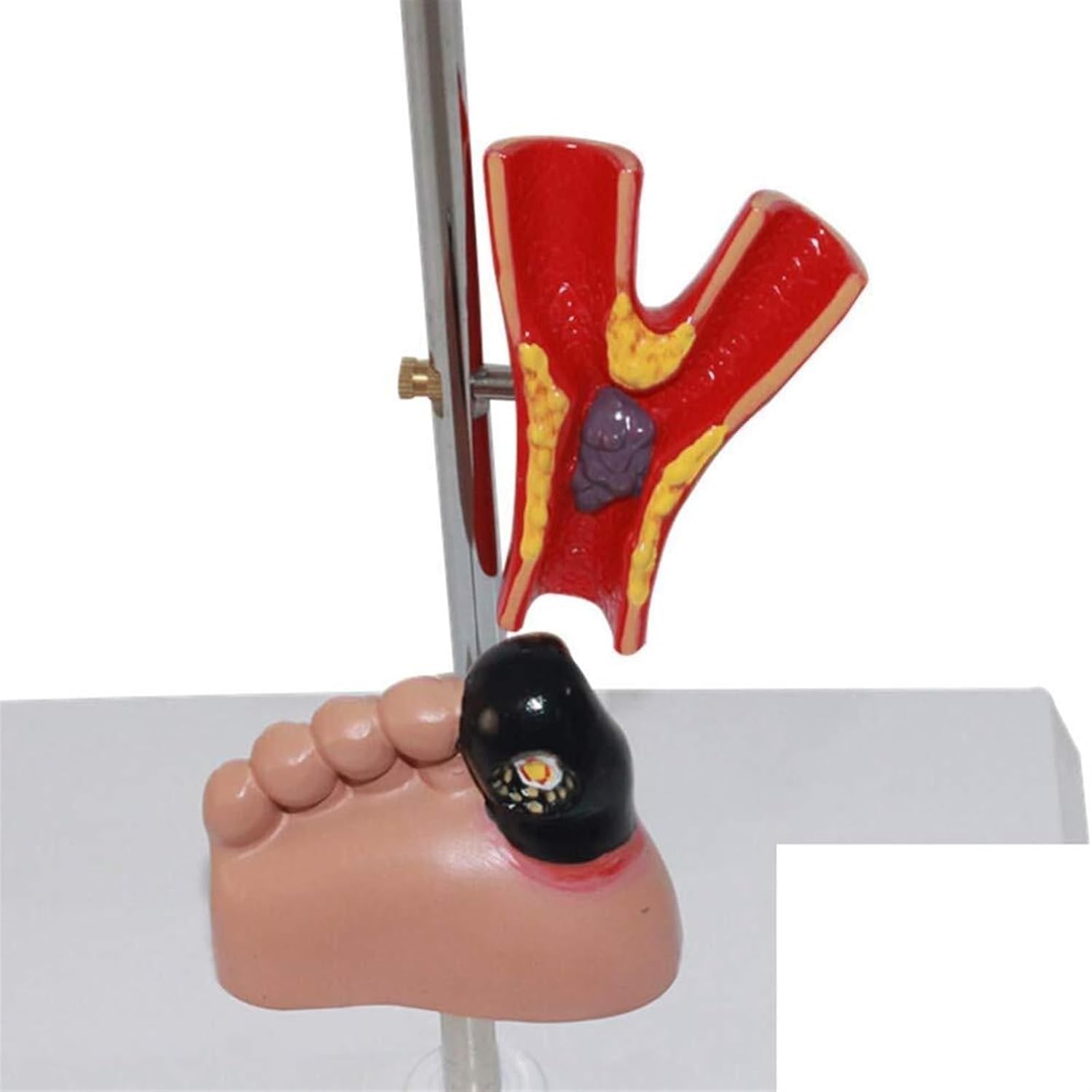 CHROX Modèle De Diabète en PVC, Modèle Humain, Modèle De Rein, Modèle D'organe, Modèle De Diabète : Œil, Rein, Système Cardiovasculaire, Modèle De Pied (avec 5 Parties Mobiles)