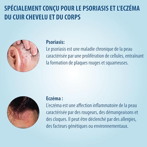 Evolsin® Shampooing contre l'eczéma et le psoriasis pour cheveux secs et irrités 250 ml - Alimente et soulage les démang
