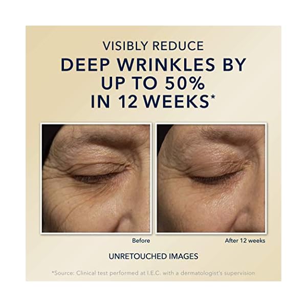 RoC Retinol Correxion Deep Wrinkle Anti-Aging Night Cream, Daily Face Moisturizer with Shea Butter, Glycolic Acid and Squalane, Stocking Stuffers for Men & Women, 1 Ounces (Packaging May Vary)