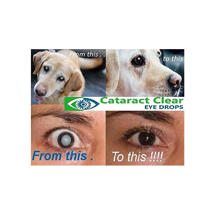 Buy Cataract Clear Eye Drops. 2 x 0.35fl oz/10 ml Bottles. 4 Times More