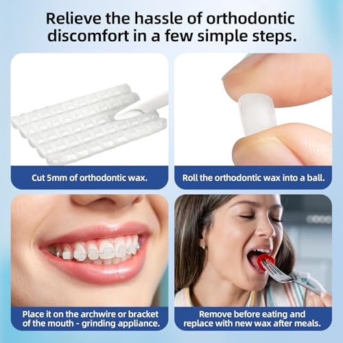 RAZOKO Zahnspangenwachs – Vorgeschnittenes Zahnwachs mit starker Haftung, 750 Stk., lebensmittelecht, komfortabler Schutz für Kinder & Erwachsene, tragbares Reiseetui, Erdbeere