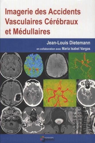 IMAGERIE DES ACCIDENTS VASCULAIRES CEREBRAUX ET MEDULLAIRES