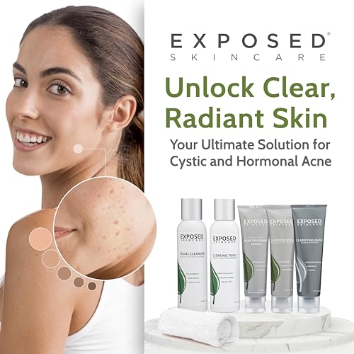 Exposed Skin Care Acne Treatment Kit - Includes Facial Cleanser, Clearing Tonic, Acne Treatment Serum, Clear Pore Serum, Clarifying Mask, Cloth - Natural Acne Solution for Face, All Ages & Skin Types 5 Exposed Skin Care Acne Treatment Kit - Includes Facial Cleanser, Clearing Tonic, Acne Treatment Serum, Clear Pore Serum, Clarifying Mask, Cloth - Natural Acne Solution for Face, All Ages & Skin Types