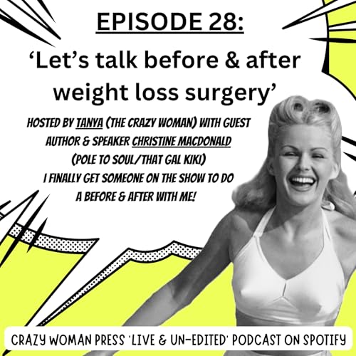 EP28: 'Let's talk before & after weight loss surgery' Titelbild