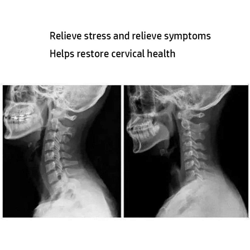 Conjunto De Dispositivos De TraccióN Cervical, sobre La Puerta Dispositivos DescompresióN De La Columna Vertebral MáQuina OrtopéDica TraccióN Arriba Conjunto Fisioterapia Alivio del Dolor