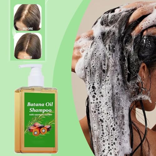 Batana Oil Shampoo, Shampoo De Batana - Shampoo Para La Caida De Cabello, Batana Oil Shampoo, Batana Oil Rosemary Shampoo for All Hair Types - Image 3