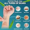 Medical Grade Silicone Scar Tape Aloe Vera | 4cm x 1.2M | Silicone Scar Sheets for After Surgery C Section Recovery, Face Treatment Gel Patches/Plasters #4