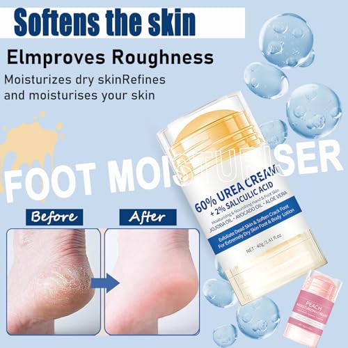 Hydrating and Anti-Cracking Foot Cream, 2Pcs Urea Fußcreme 60%, Feuchtigkeitsspendende und Anti-Riss-Fußcreme, Lindert Extreme Trockenheit und Rissbildung der Hände und Füsse – Bild 5