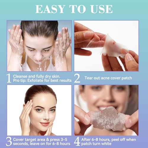 Vigorder Nose Pore Patches, Hydrocolloid Nose Patches, Targets Pimple, Pores & Oil (5 Pack)