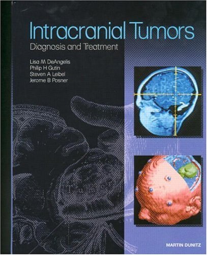 Intracranial Tumors: Diagnosis and Treatment Intracranial Tumors: Diagnosis and Treatment