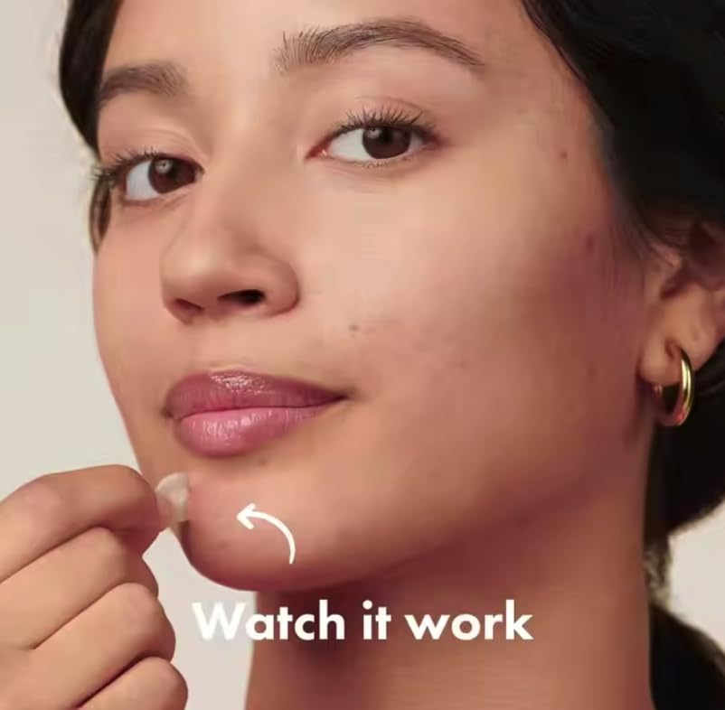 Acne Patch Original patch from Easifylife - Hydrocolloid Acne Pimple Patch for Covering Zits and Blemishes in Face and Skin, Vegan-friendly and Not Tested on Animals (36 Count)