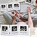 Amyhill Triple Ultrasound Picture Frames, Baby Sonogram Photo Frame Pregnancy Ultrasound Keepsake Frame, Gift for Expecting Parents, Baby Shower Nursery Decor, White
