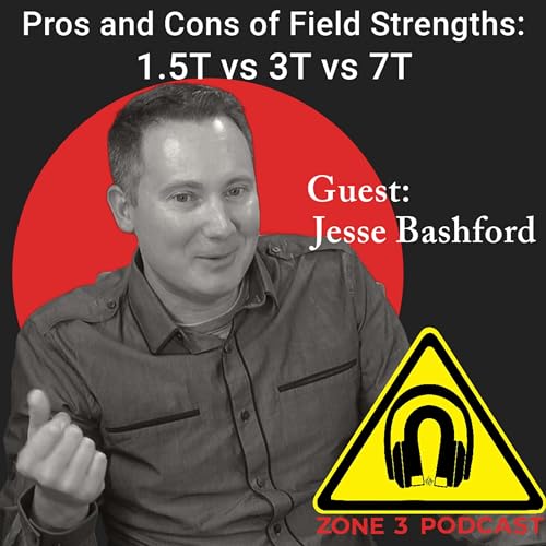 Pros and Cons of Field Strengths: 1.5T vs 3T vs 7T
