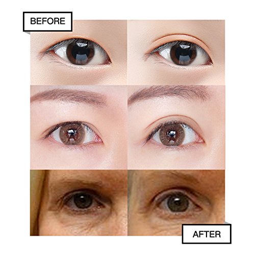 400Pcs Natural Invisible Single Side Eyelid Tape Stickers Medical-use Fiber Eyelid Lift Strip, Instant Eye Lift Without Surgery, Perfect for Uneven Mono-Eyelids, 100 Pairs Slim + 100 Pairs Wide - Thumbnail 7
