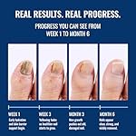 Approved Science Fungix - Undecylenic Acid & Tea Tree Oil - Serum for Fingernail and Toenail Care - Infused with Essential Oils - Nail Appearance Support - Pack of 1 - Image 4