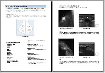 表在エコーの実学─乳腺・甲状腺・その他─ | 杉山 高 |本