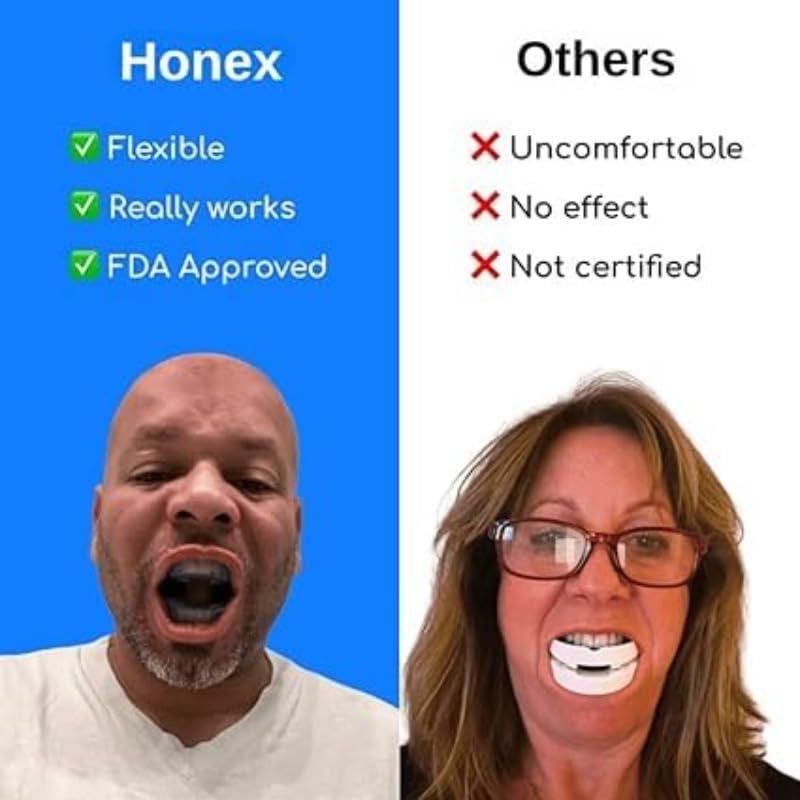 Honex Anti Russamento/Honex Anti Snoring Mouthpiece