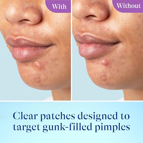 Image of Differin Power Patches for White Head Pimples, Hydrocolloid Patches formulated with Zinc Hyaluronate and Niacinamide, 4-in-1 Hydrotech Formula, Helps Absorb Impurities and Restore Skin, 23 ct