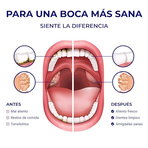 Oravix Irrigador dental portatil, Irrigador bucal con 2 boquillas: Limpieza dental y Extractor de tonsilolitos, Solución para eliminar el mal aliento, Depósito agua 90ml, Irrigador dental viaje - imagen 7