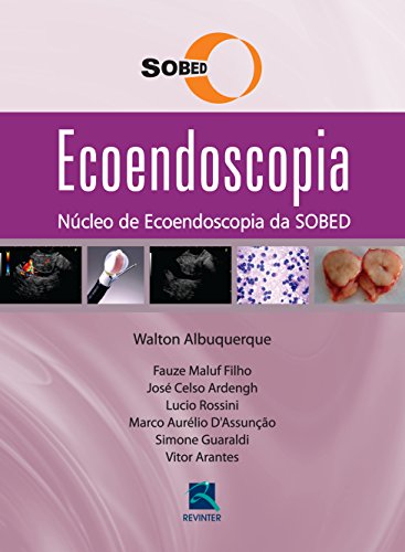 Ecoendoscopia