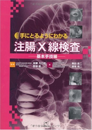 注腸X線検査〜基本手技編〜 (手にとるようにわかる) | 奥田 圭二, 腰塚