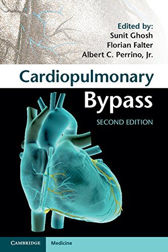 Cardiopulmonary Bypass (English Edition)