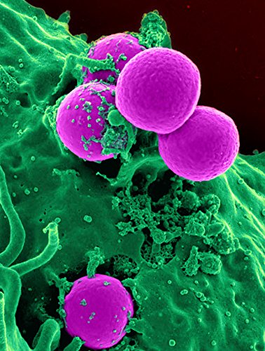 Scanning electron micrograph of a human neutrophil ingesting MRSA Poster Print by National Institutes of HealthStocktrek Images (11 x 17)