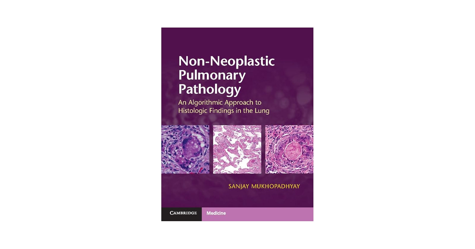健康・医学 Diagnostic Atlas of Non-Neoplastic Lung Diagnostic Atlas of Non-Neoplastic Lung Disease: A Practical