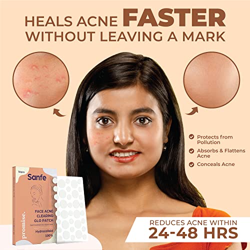Image of Sanfe Promise Face Acne Pimple Patch - Pack of 144 | Pimple Healing & Spot Clearing Patch | Absorbing Cover |Invisible, Blemish Spot, Hydrocolloid, Skin Treatment