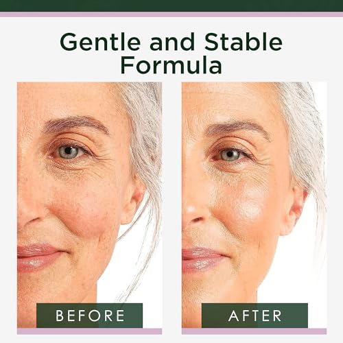 Tree of Life Beauty Retinol Serum, Skin Smoothing Face Oil for Dark and Age Spots and Fine Lines, Facial Serums for Dry and Sensitive Skin Care with Hyaluronic Acid for Soft Smooth Skin, 2 Fl Oz - Image 4