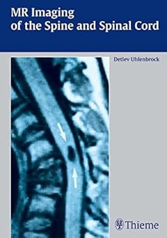 MR Imaging of the Spine and Spinal Cord by Detlev Uhlenbrock book cover