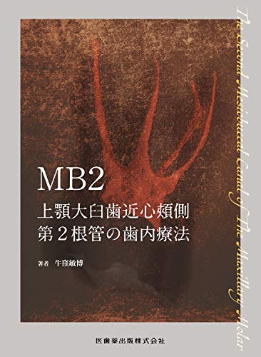 PDFダウンロード MB2 上顎大臼歯近心頬側第2根管の歯内療法 バイ