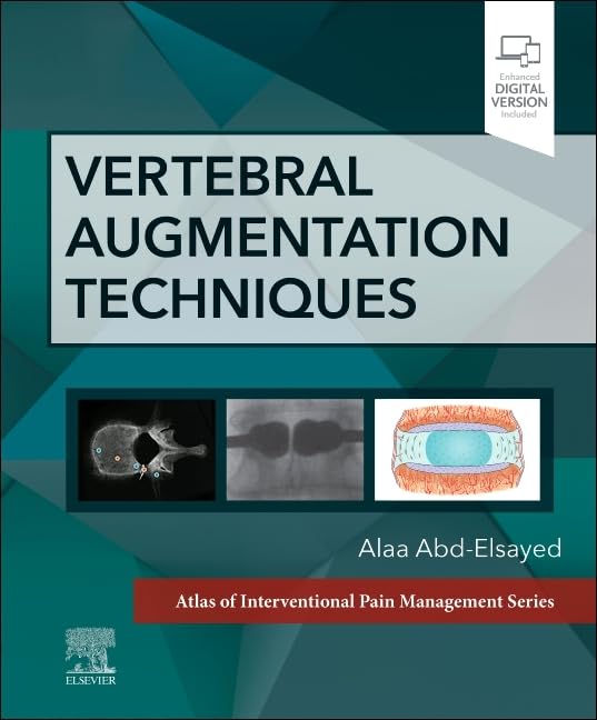 Vertebral Augmentation Techniques (Atlas of Interventional Pain Management)      1st Edition